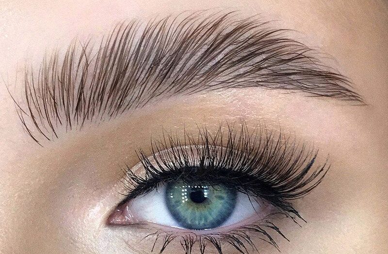 brow lift